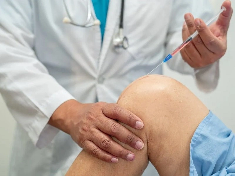 مراقبتهای بعد از درمان غیر جراحی آرتروز