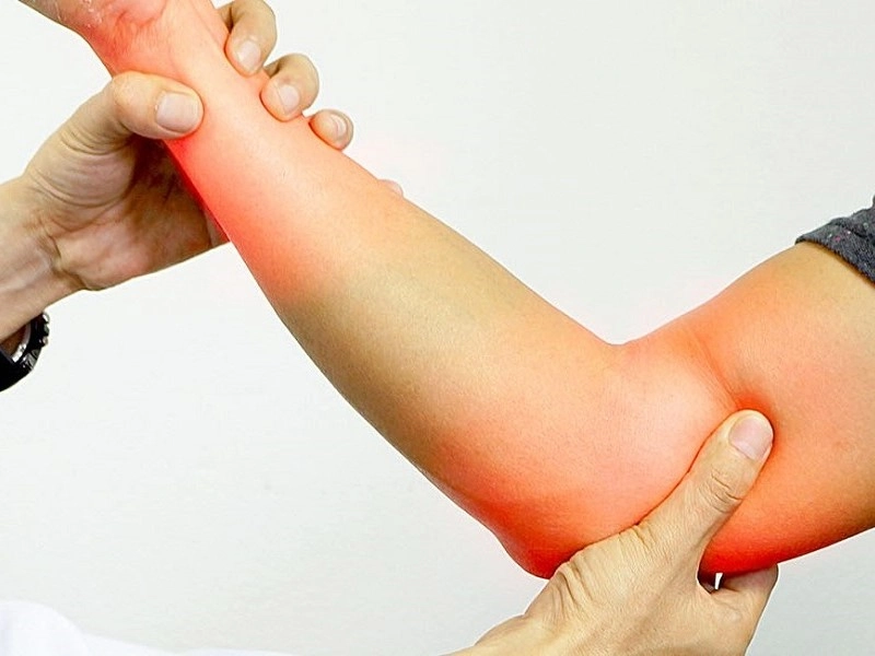 انواع آرتروز آرنج دست