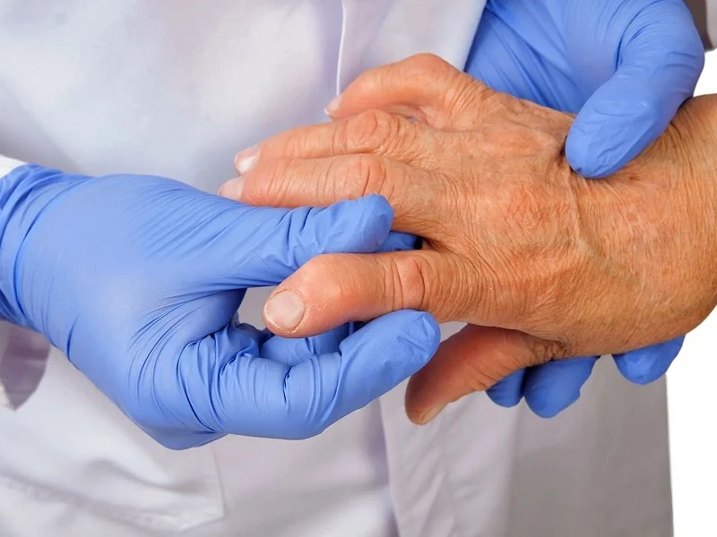 جراحی تعویض مفصل