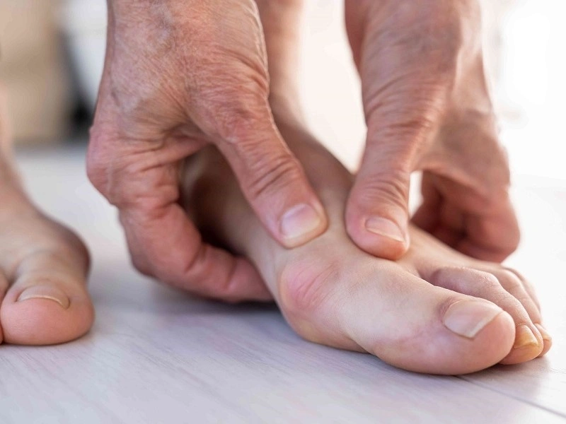 درمان خانگی آرتروز انگشت پا