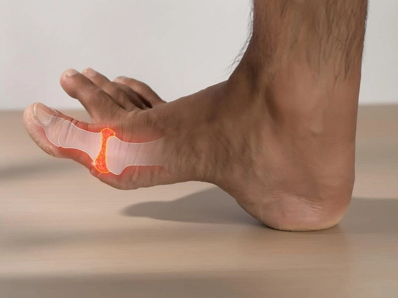 علت آرتروز شست پا