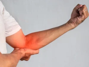 هرآنچه باید درباره آرتروز آرنج بدانید + جدیدترین روش‌های درمان