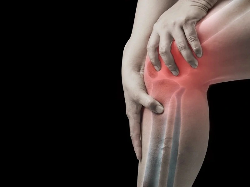 آیا میتوان از پارگی تاندون زانو پیشگیری کرد؟