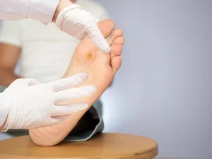 راهنمای جامع زخم دیابتی؛ از تشخیص تا درمان قطعی