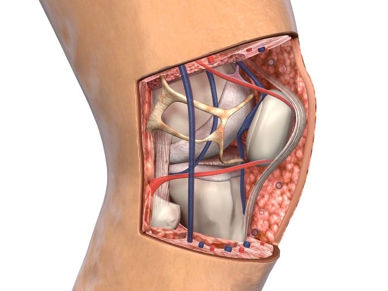 پارگی تاندون زانو چیست؟