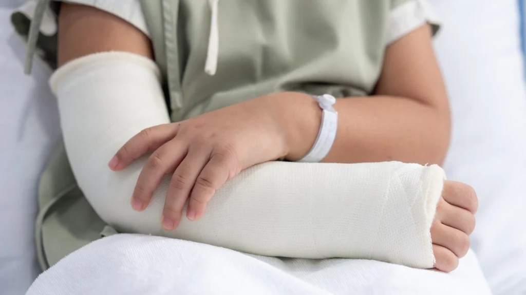 arm fracture