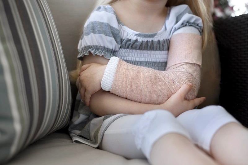 Caring for a broken arm at home