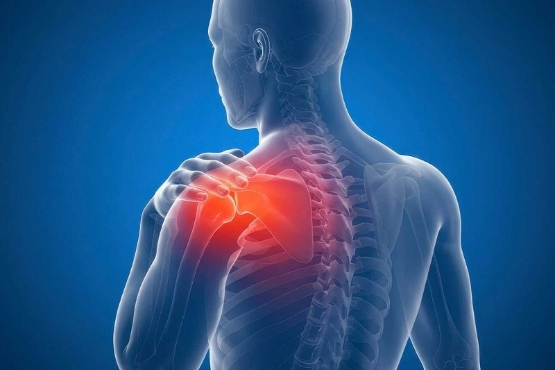 Causes of frozen shoulder