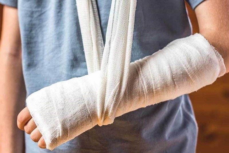 Cause of arm fracture