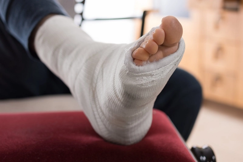 In which areas are leg fractures more common?