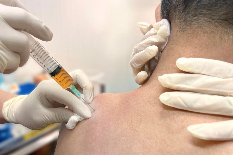 Injection for frozen shoulder