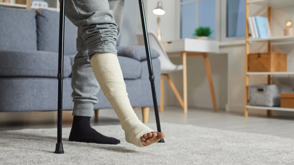 leg fracture
