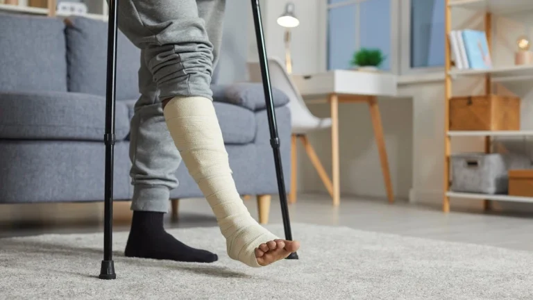 leg fracture