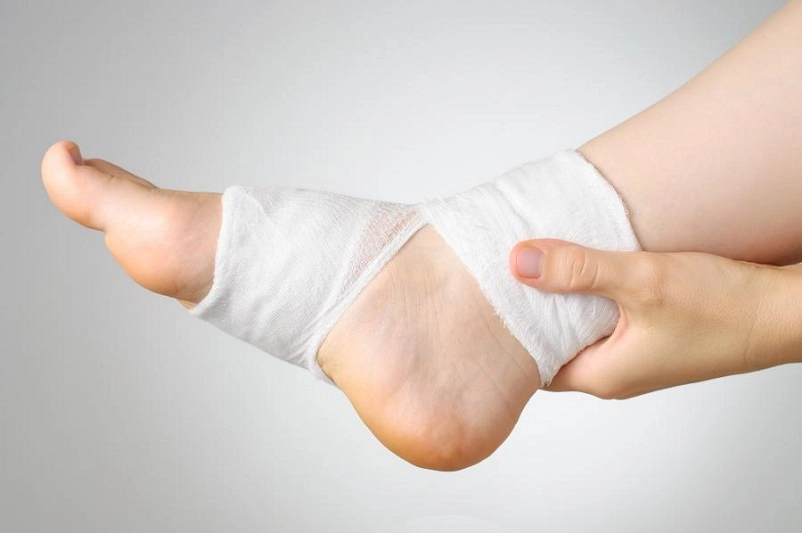 Types of ankle fractures