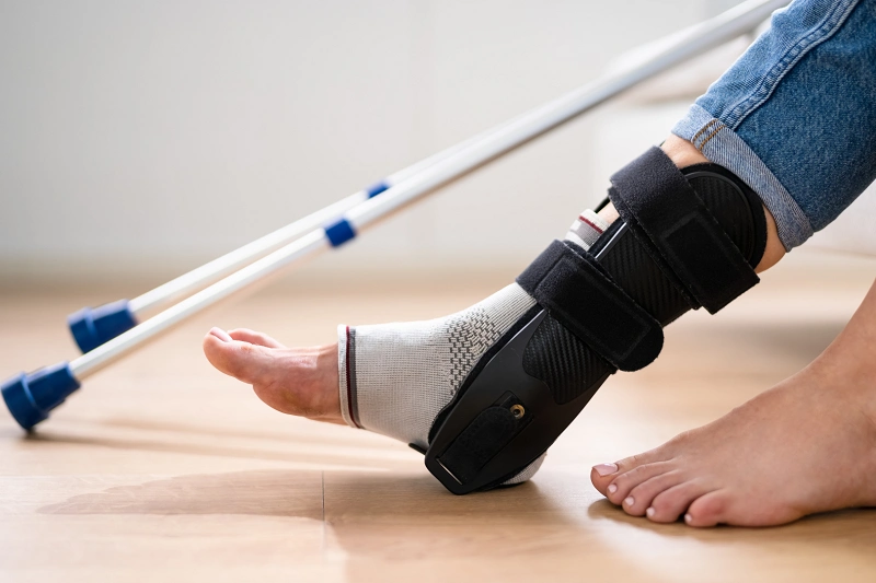 Walking after an ankle fracture