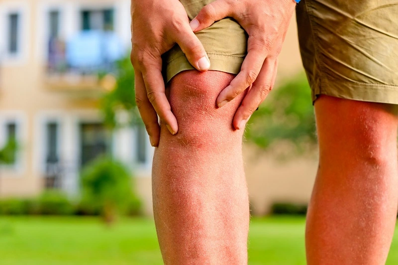 Which movements worsen foot swelling?