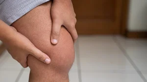 knee osteoarthritis and leg swelling